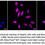 Thumbnail: KD-Validated Anti-Neuronal Calcium Sensor 1 Rabbit Monoclonal Ab#62262
