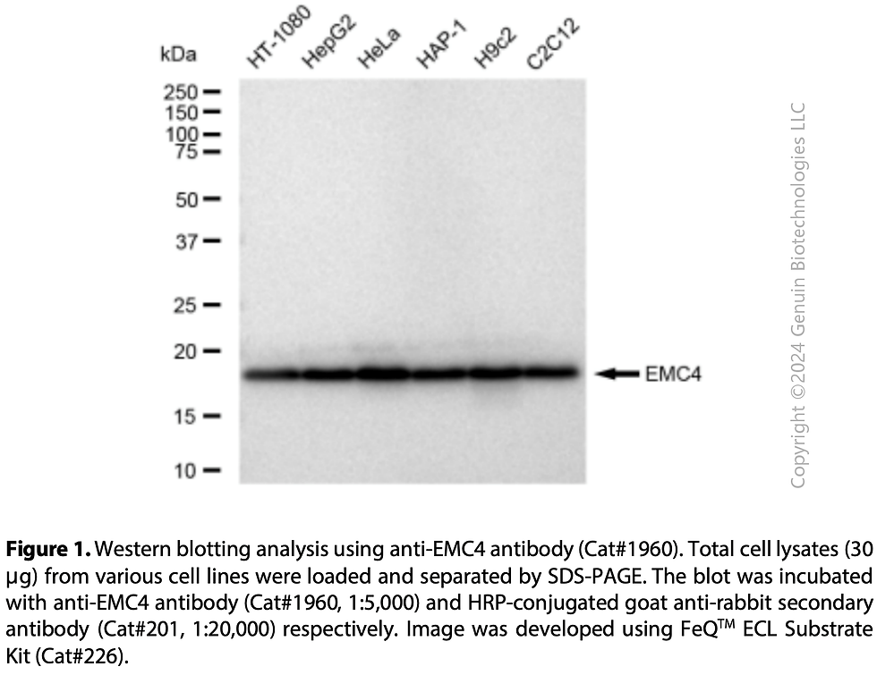 Thumbnail: Anti-EMC4 Rabbit mAb #1960