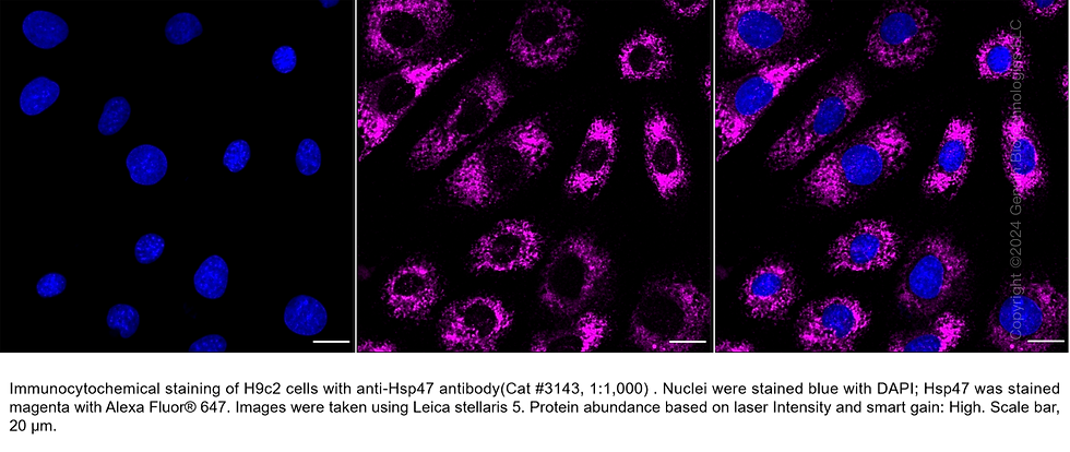 Thumbnail: Anti-Serpin Family H Member 1 Rabbit mAb #3143