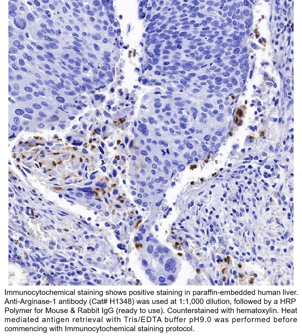 Thumbnail: Anti-Arginase-1 Rabbit Monoclonal Ab #H1348