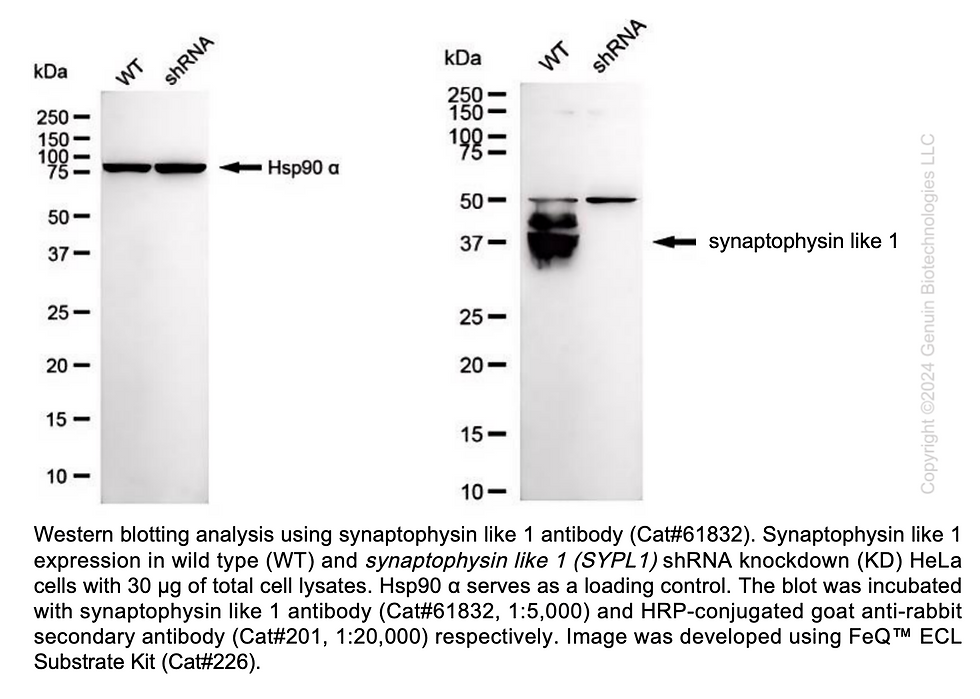 Thumbnail: KD-Validated Anti-Synaptophysin like 1 Rabbit Monoclonal Ab#61832