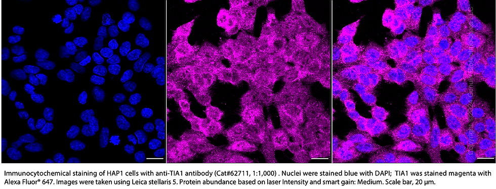 Thumbnail: KD-Validated Anti-TIA1 Rabbit Monoclonal Ab#62711