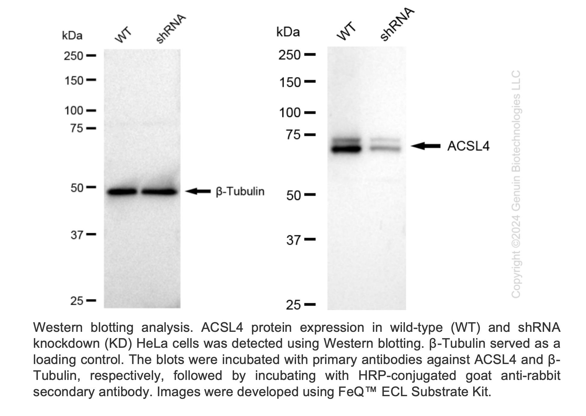 WB-Validated ACSL4 Lentiviral shRNA Knockdown Kit #V61331
