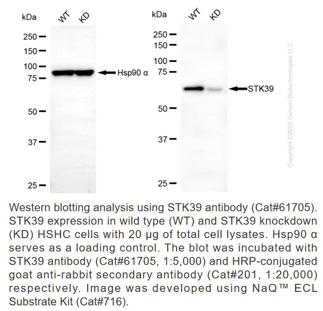 Thumbnail: KD-Validated Anti-Serine/Threonine Kinase 39 Rabbit Monoclonal Ab #61705