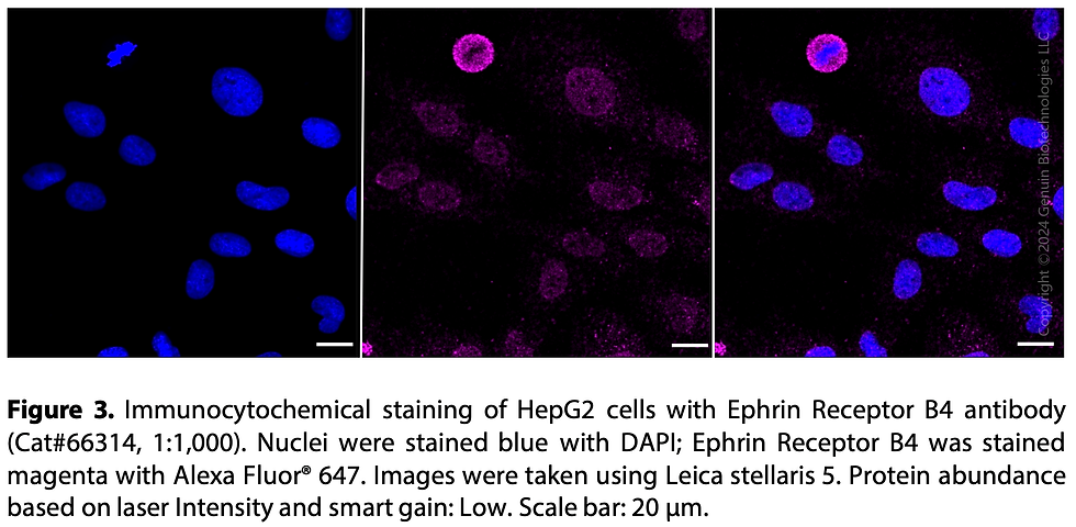 Thumbnail: KD-Validated Anti-Ephrin Receptor B4 Rabbit Monoclonal Ab#66314