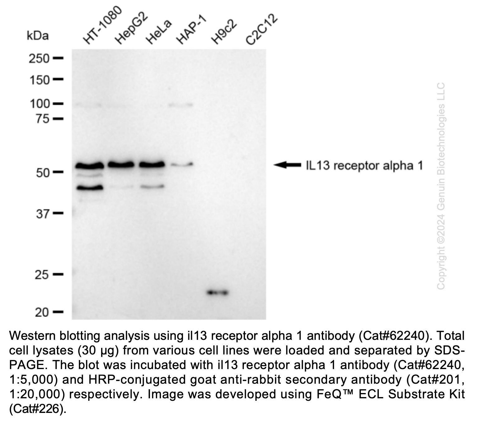 KD-Validated Anti-IL13 Receptor Alpha 1 Rabbit Monoclonal Ab#62240