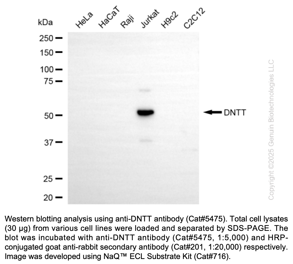 Anti-DNTT Rabbit mAb #5475