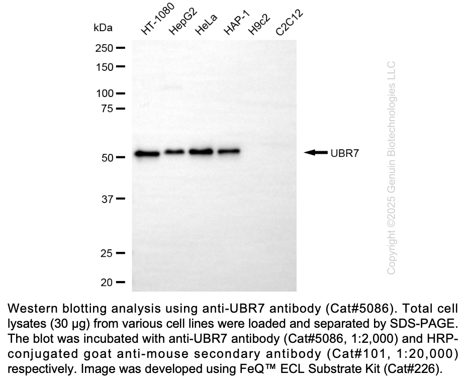 Anti-UBR7 Mouse Monoclonal Ab #5086