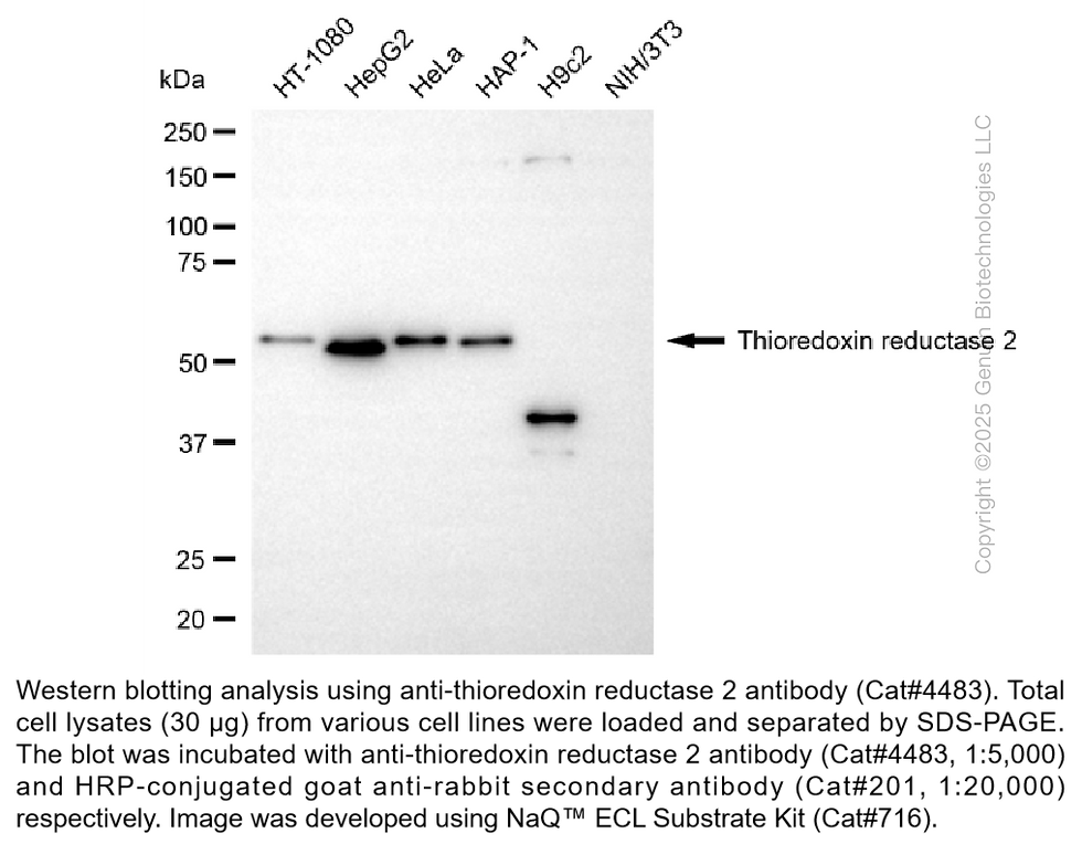 Anti-Thioredoxin reductase 2 Rabbit Monoclonal Ab #4483