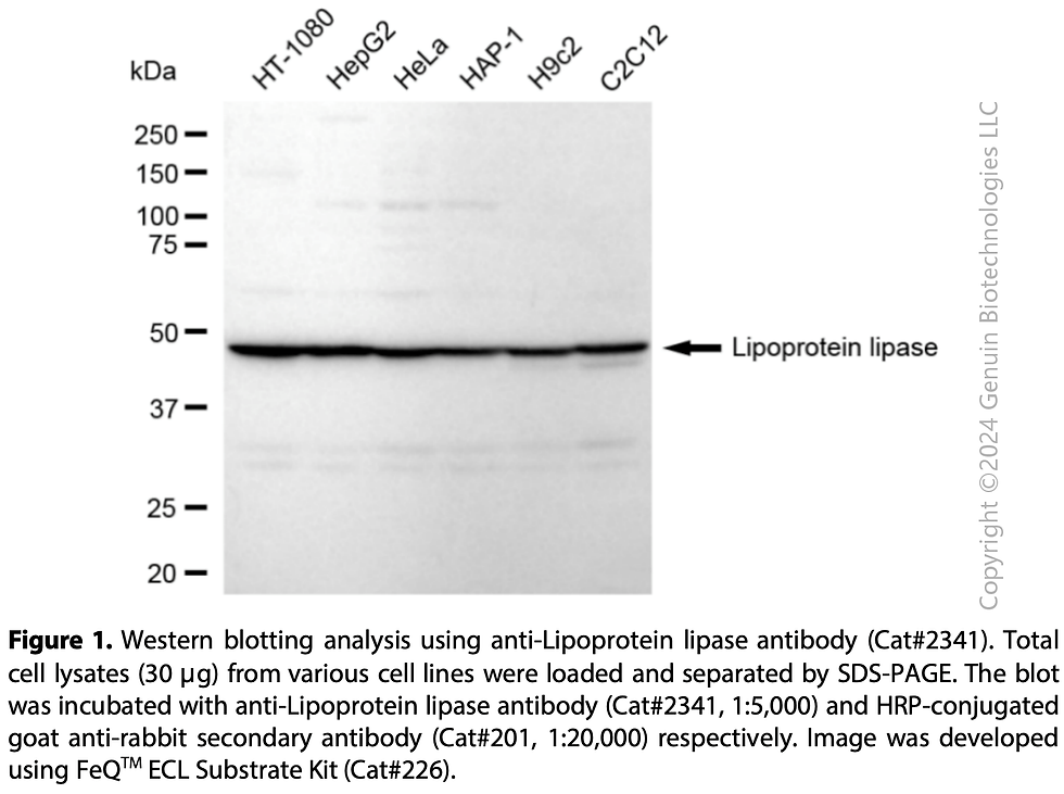Thumbnail: Anti-Lipoprotein Lipase Rabbit mAb #2341