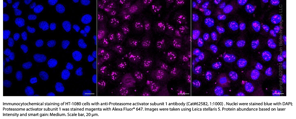 Thumbnail: KD-Validated Anti-Proteasome Activator Subunit 1 Rabbit Monoclonal Ab#62582