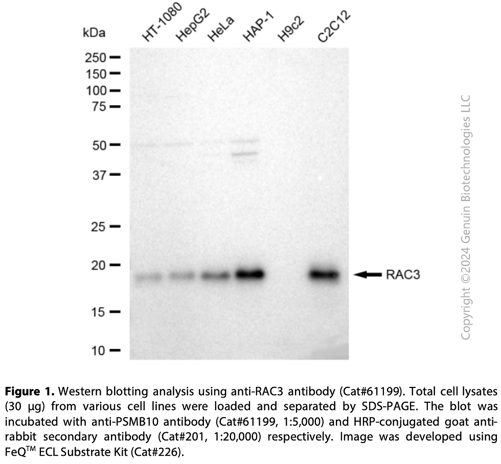 KD-Validated Anti-RAC3 Rabbit mAb #61199