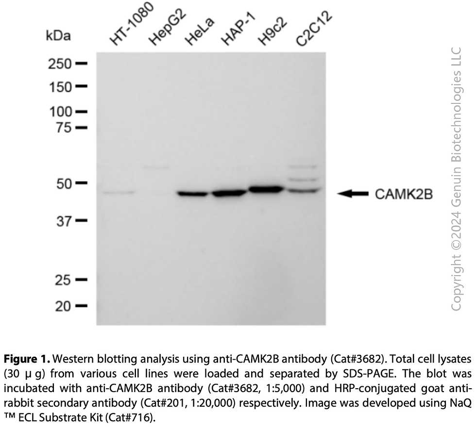 Thumbnail: Anti-CAMK2B Rabbit Monoclonal Ab #3682