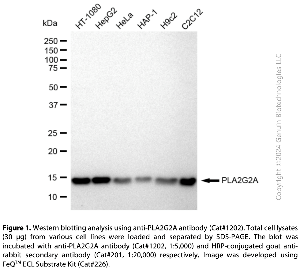 Thumbnail: Anti-PLA2G2A Rabbit mAb #1202