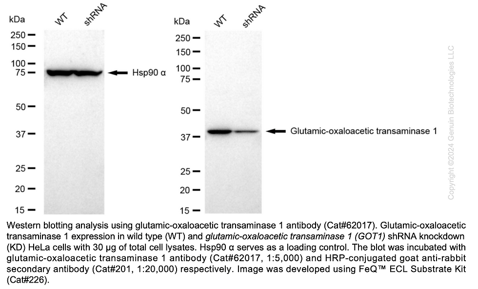 Thumbnail: KD-Validated Anti-Glutamic-Oxaloacetic Transaminase 1 Rabbit mAb#62017