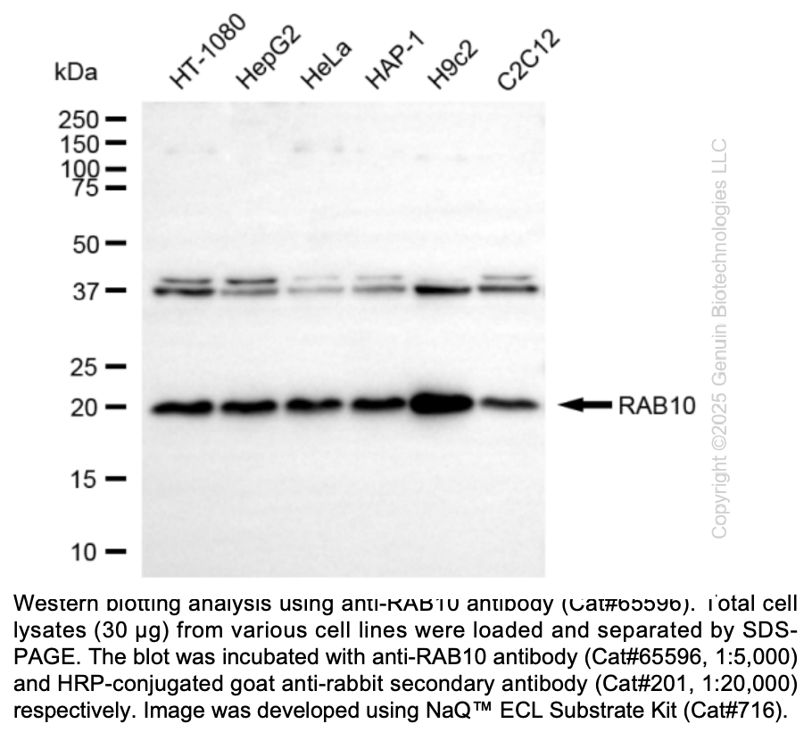 KD-Validated Anti-RAB10 Rabbit Monoclonal Ab #65596