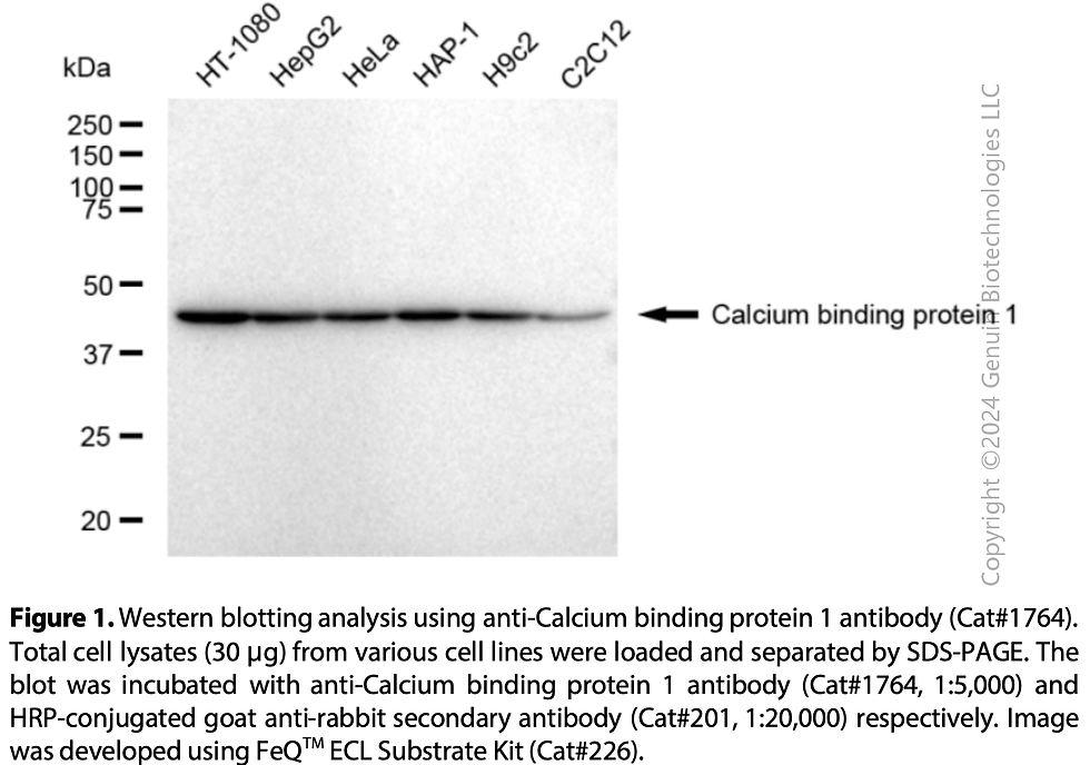 Thumbnail: Anti-Calcium Binding Protein 1 Rabbit mAb #1764