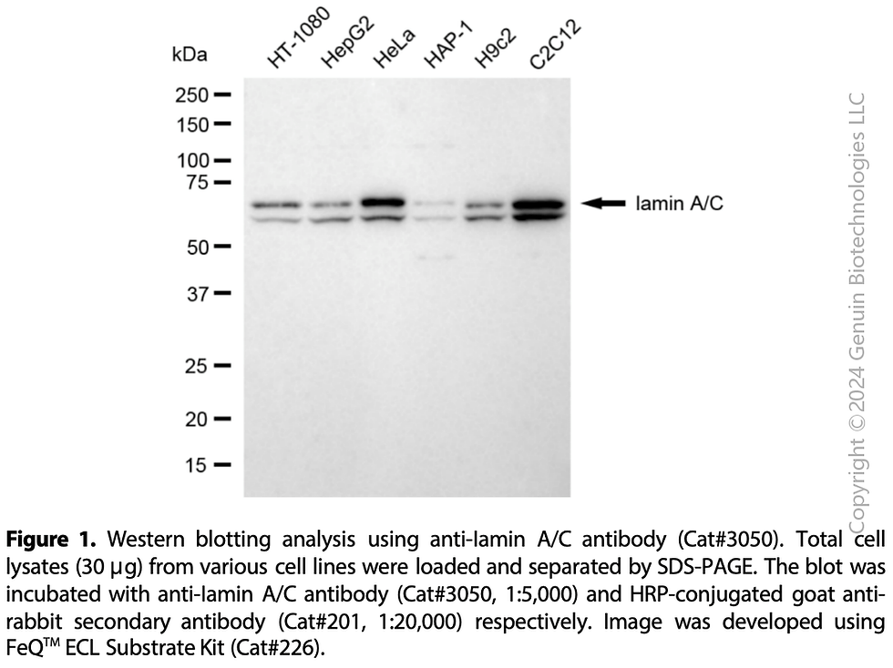 Thumbnail: Anti-Lamin A/C Rabbit mAb #3050