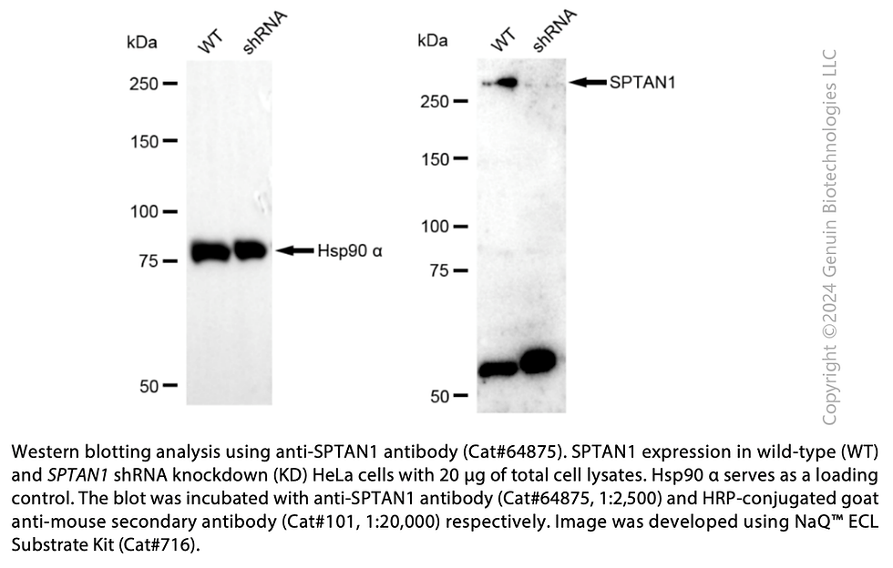 Thumbnail: KD-Validated Anti-SPTAN1 Mouse Monoclonal Ab #64875