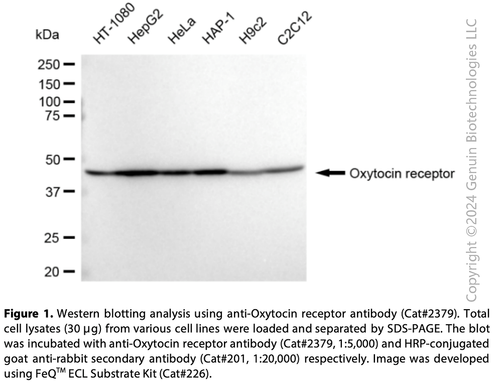 Thumbnail: Anti-Oxytocin Receptor Rabbit mAb #2379