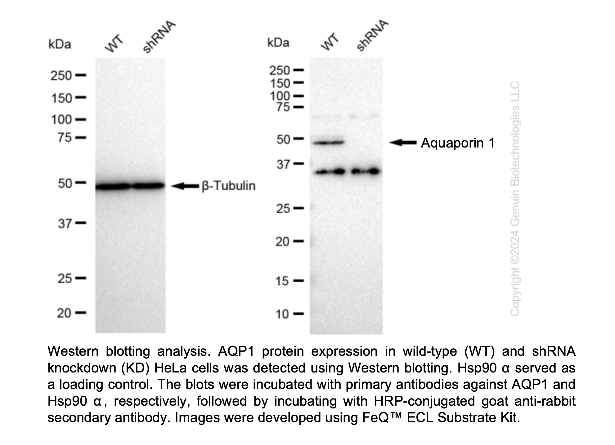 WB-Validated AQP1 Lentiviral shRNA Knockdown Kit#V68661