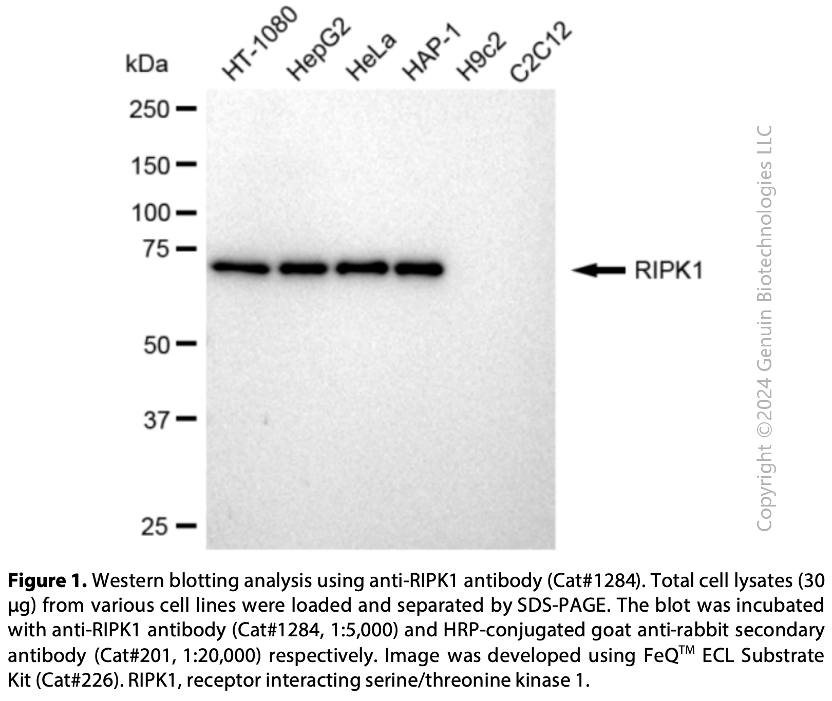Anti-RIPK1 Rabbit mAb #1284