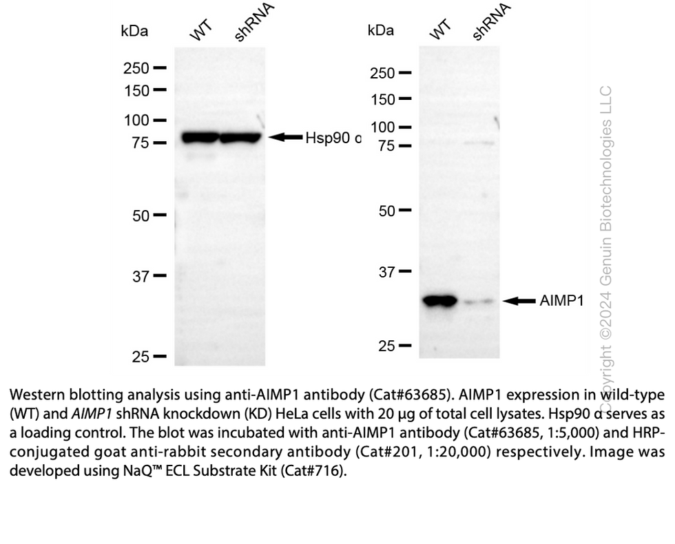 Thumbnail: KD-Validated Anti-AIMP1 Rabbit Monoclonal Ab #63685