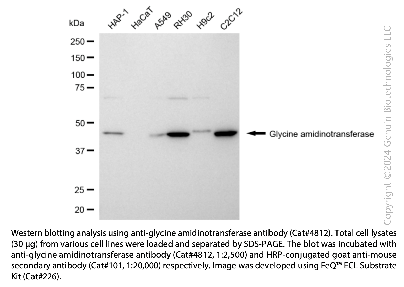 Anti-GATM Mouse Monoclonal Ab #4812