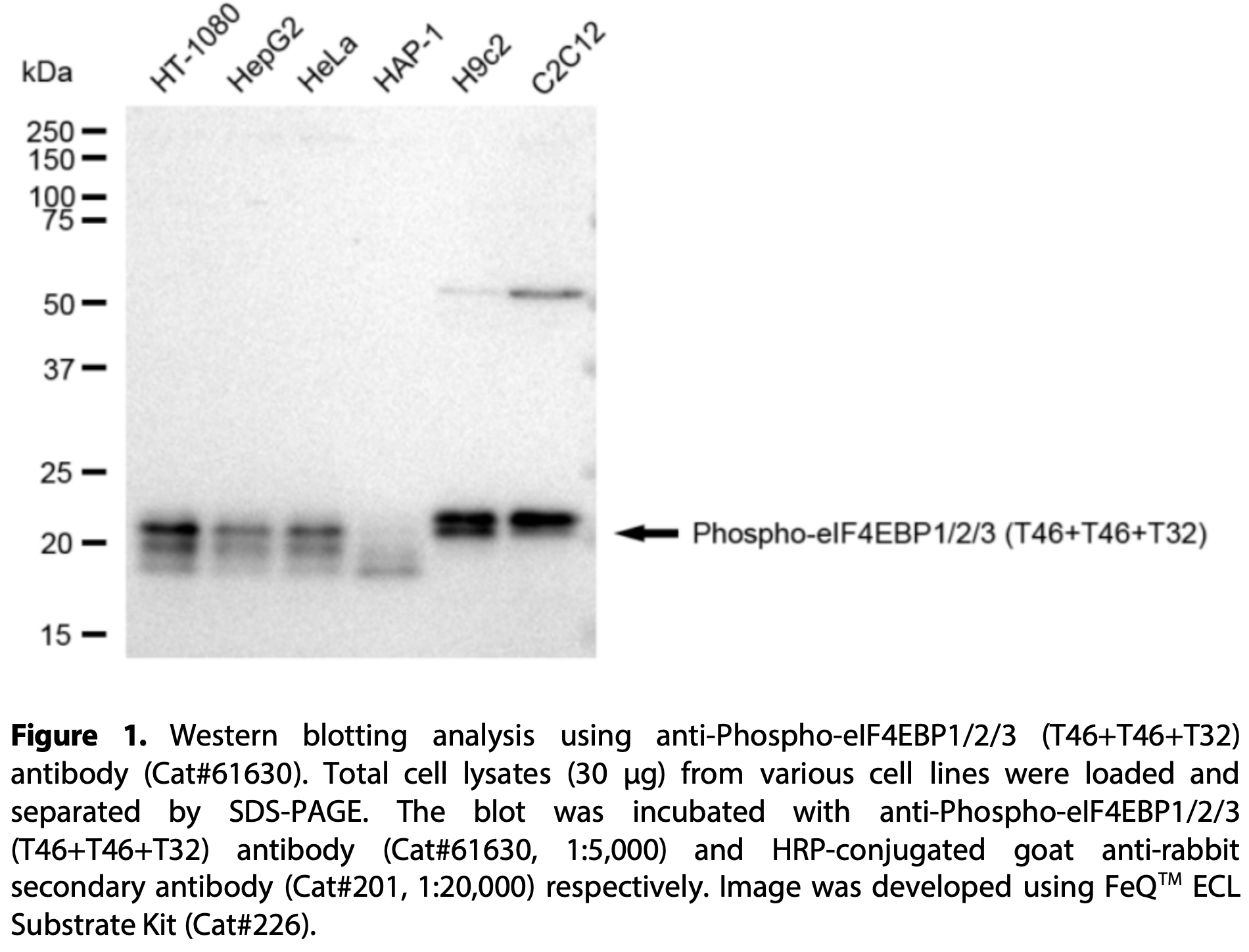 KD-Validated Anti-Phospho-eIF4EBP1/2/3 (T46+T46+T32) Rabbit Monoclonal Ab#61630