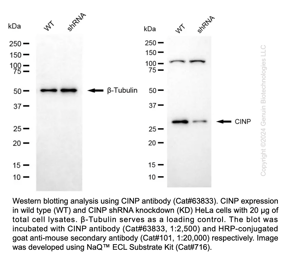Thumbnail: KD-Validated Anti-CINP Mouse Monoclonal Ab #63833