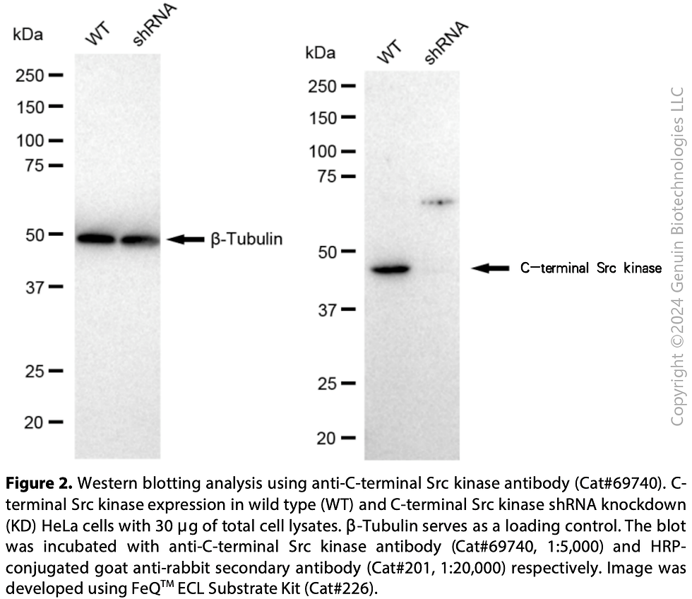 Thumbnail: KD-Validated Anti-C-Terminal Src Kinase Rabbit Monoclonal Ab #69740