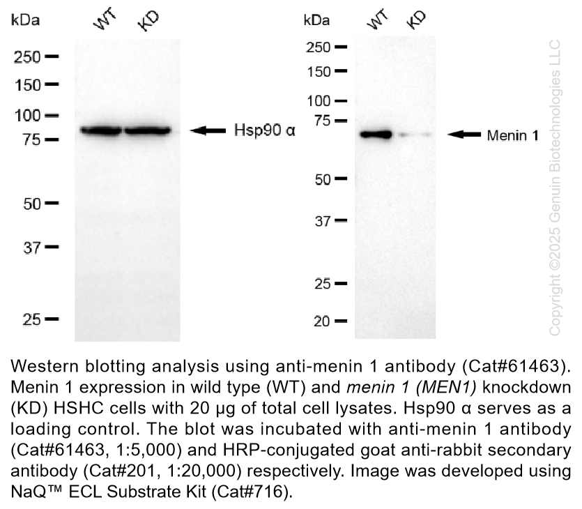 Thumbnail: KD-Validated Anti-Menin 1 Rabbit Monoclonal Ab #61463