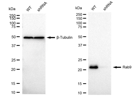 Figure 2: Immunoblotting was used to verify the Rab9 antibody (Cat#61120) in wild-type and Rab9 silenced HeLa cell lines.