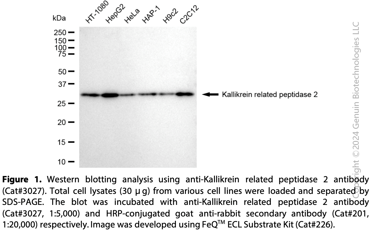 Anti-Adenosine Deaminase RNA Specific Rabbit mAb #3028