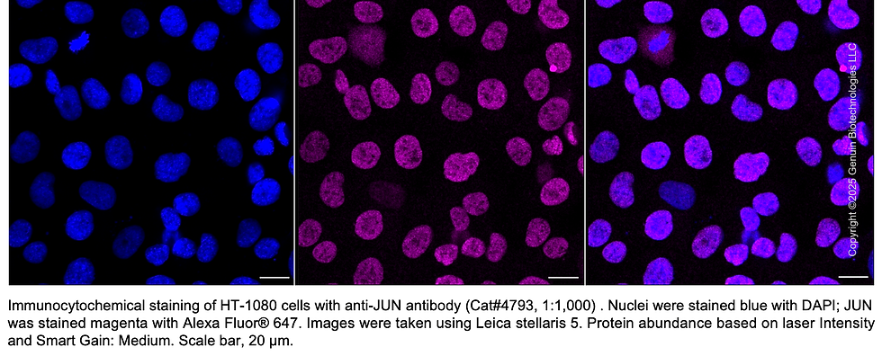 Thumbnail: Anti-JUN Mouse Monoclonal Ab #4793