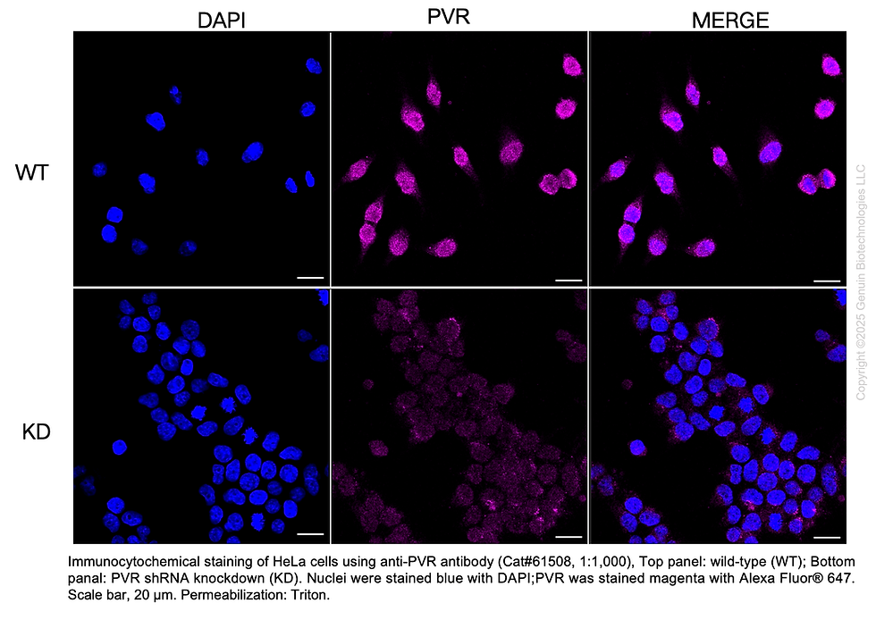 Thumbnail: KD-Validated Anti-PVR Rabbit Monoclonal Ab#61508