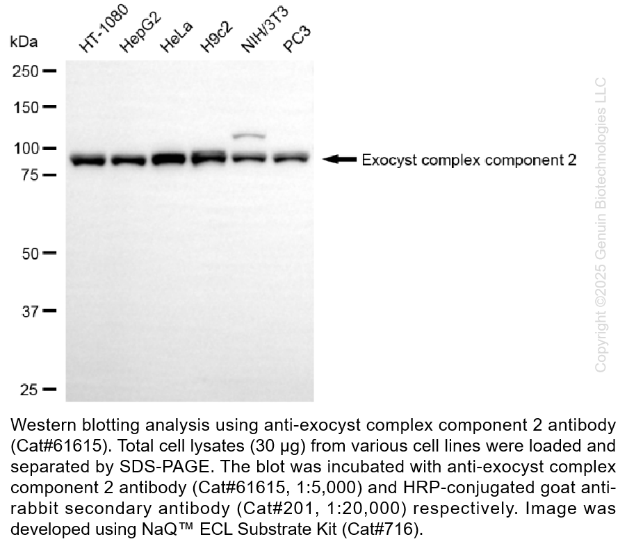 KD-Validated Anti-Exocyst Complex Component 2 Rabbit mAb #61615