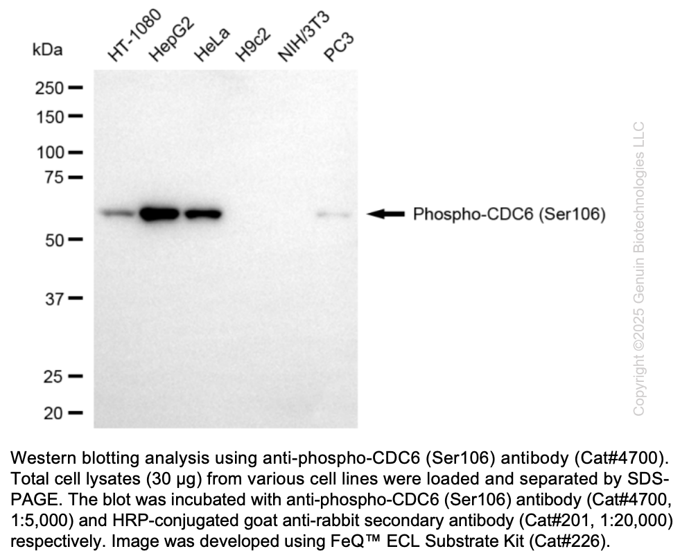 Anti-Phospho-CDC6 (Ser106) Rabbit Monoclonal Ab #4700