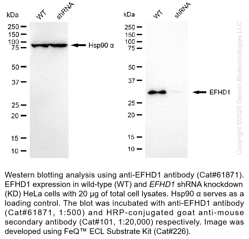 Thumbnail: KD-Validated Anti-EFHD1 Mouse Monoclonal Ab #61871