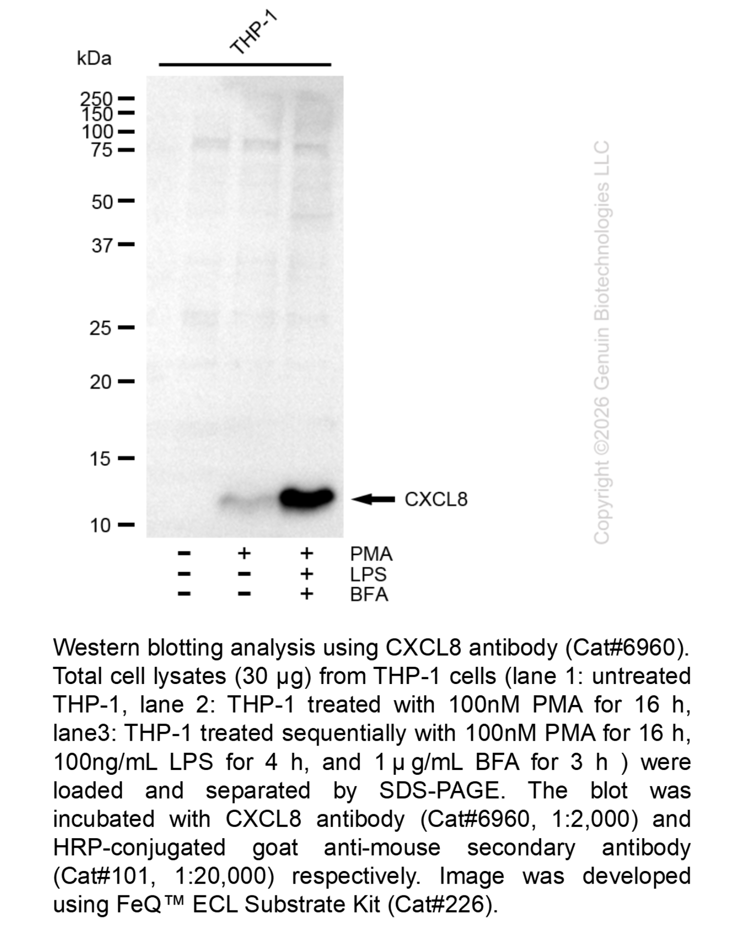 CXCL8 Mouse mAb #6960
