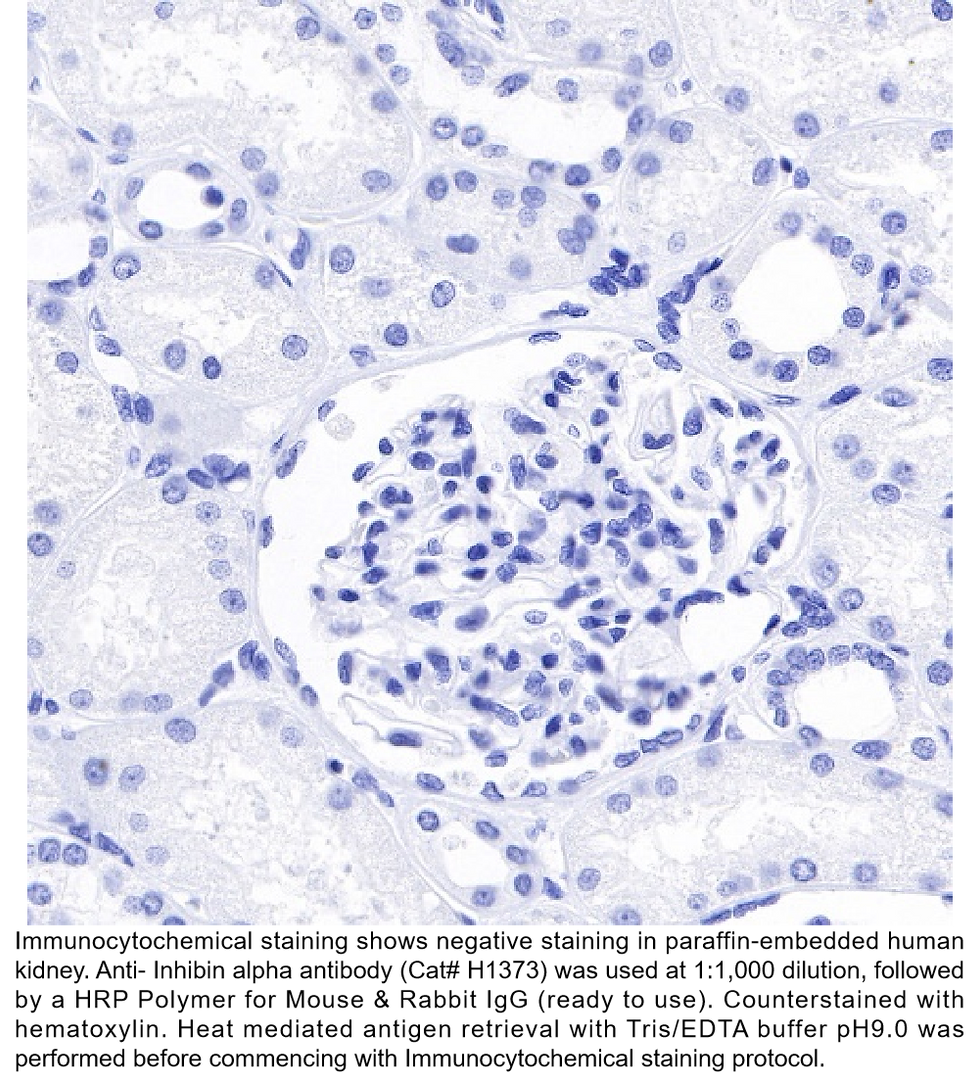 Thumbnail: Anti-Inhibin alpha Rabbit Monoclonal Ab #H1373