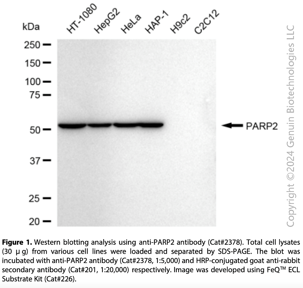 Thumbnail: Anti-Poly(ADP-Ribose) Polymerase 2 Rabbit mAb #2378