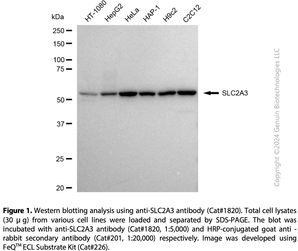 Thumbnail: Anti-SLC2A3 Rabbit mAb #1820