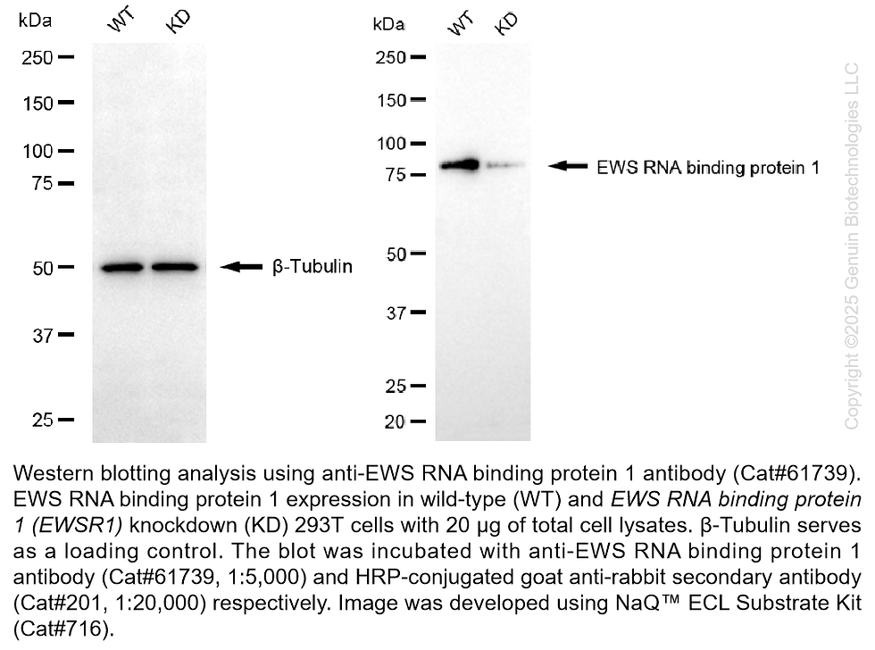 Thumbnail: KD-Validated Anti-EWS RNA Binding Protein 1 Rabbit Monoclonal Ab #61739