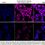 Thumbnail: KD-Validated Anti-Chromodomain Helicase DNA Binding Protein 3 Rabbit mAb #68323