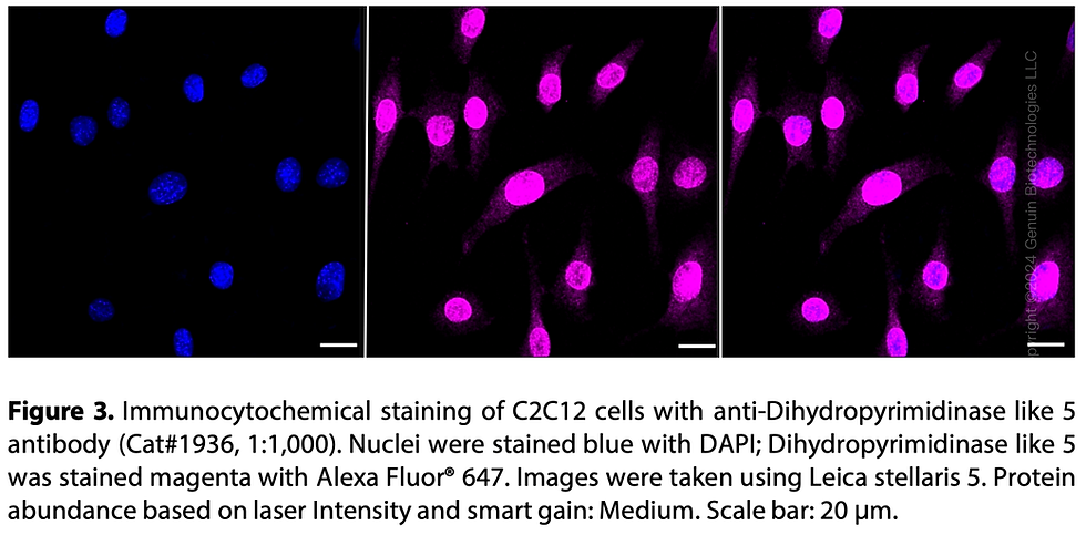 Thumbnail: Anti-Dihydropyrimidinase like 5 Rabbit mAb #1936