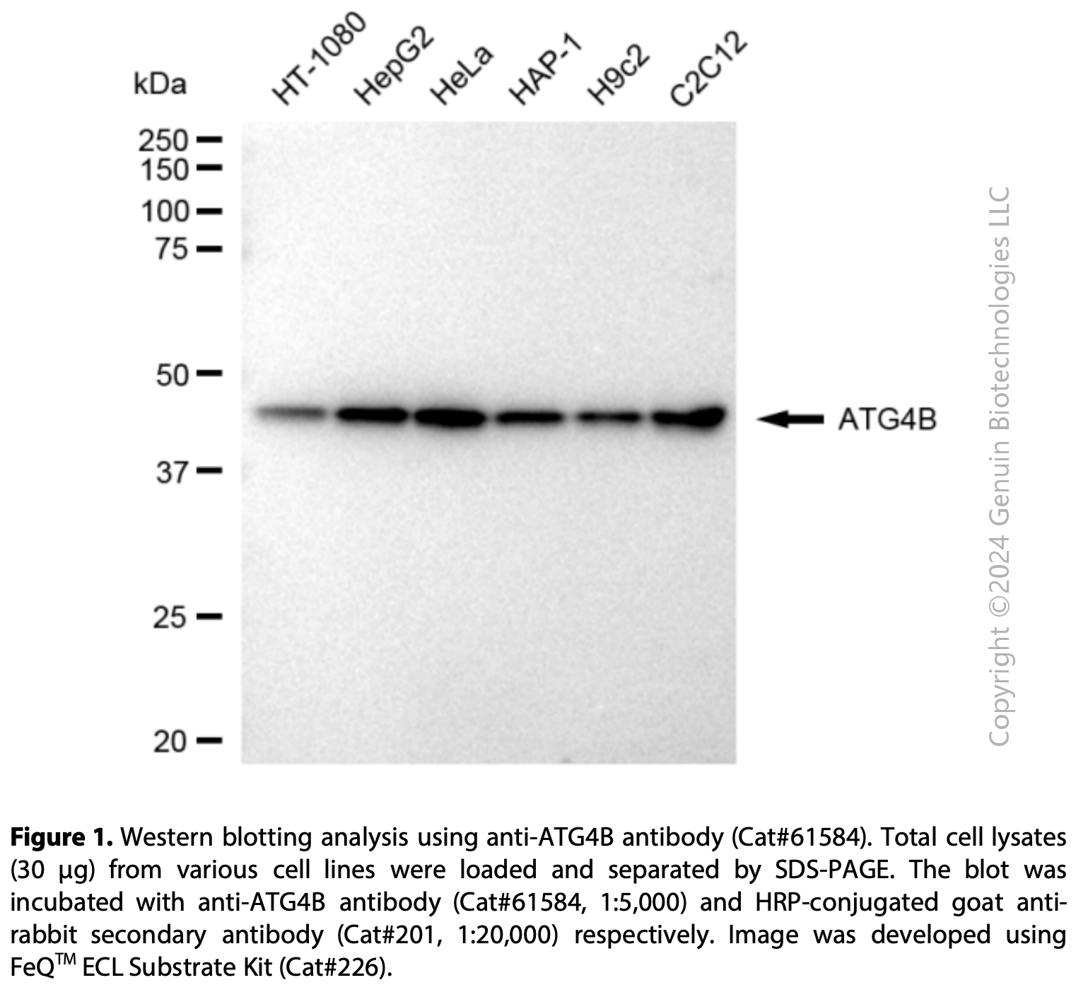 KD-Validated Anti-ATG4B Rabbit Monoclonal Ab#61584