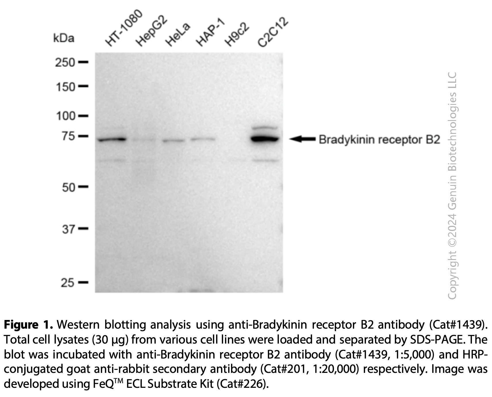 Anti-Bradykinin Receptor B2 Rabbit mAb #1439