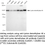 Thumbnail: Anti-Lysine demethylase 4A Rabbit mAb #2232