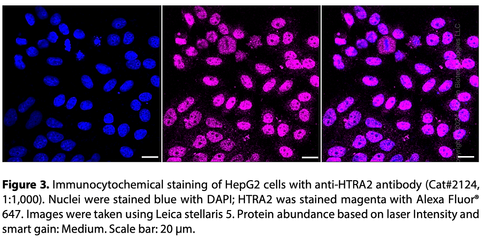 Thumbnail: Anti-HTRA2 Rabbit mAb #2124